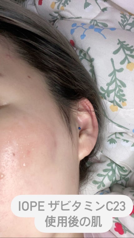 ザビタミンC23/IOPE/美容液を使ったクチコミ(3枚目)