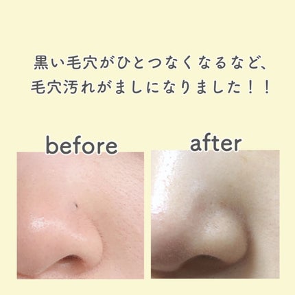 デュオ ザ ウォッシュ ブラックリペア/DUO/洗顔パウダーを使ったクチコミ(2枚目)