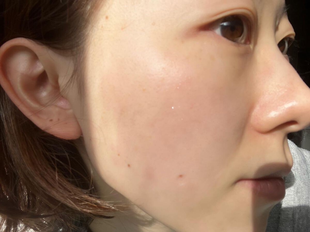 エクストラダブルホワイト美容原液Eタイプ/PlusRay/ブースター・導入液を使ったクチコミ(3枚目)