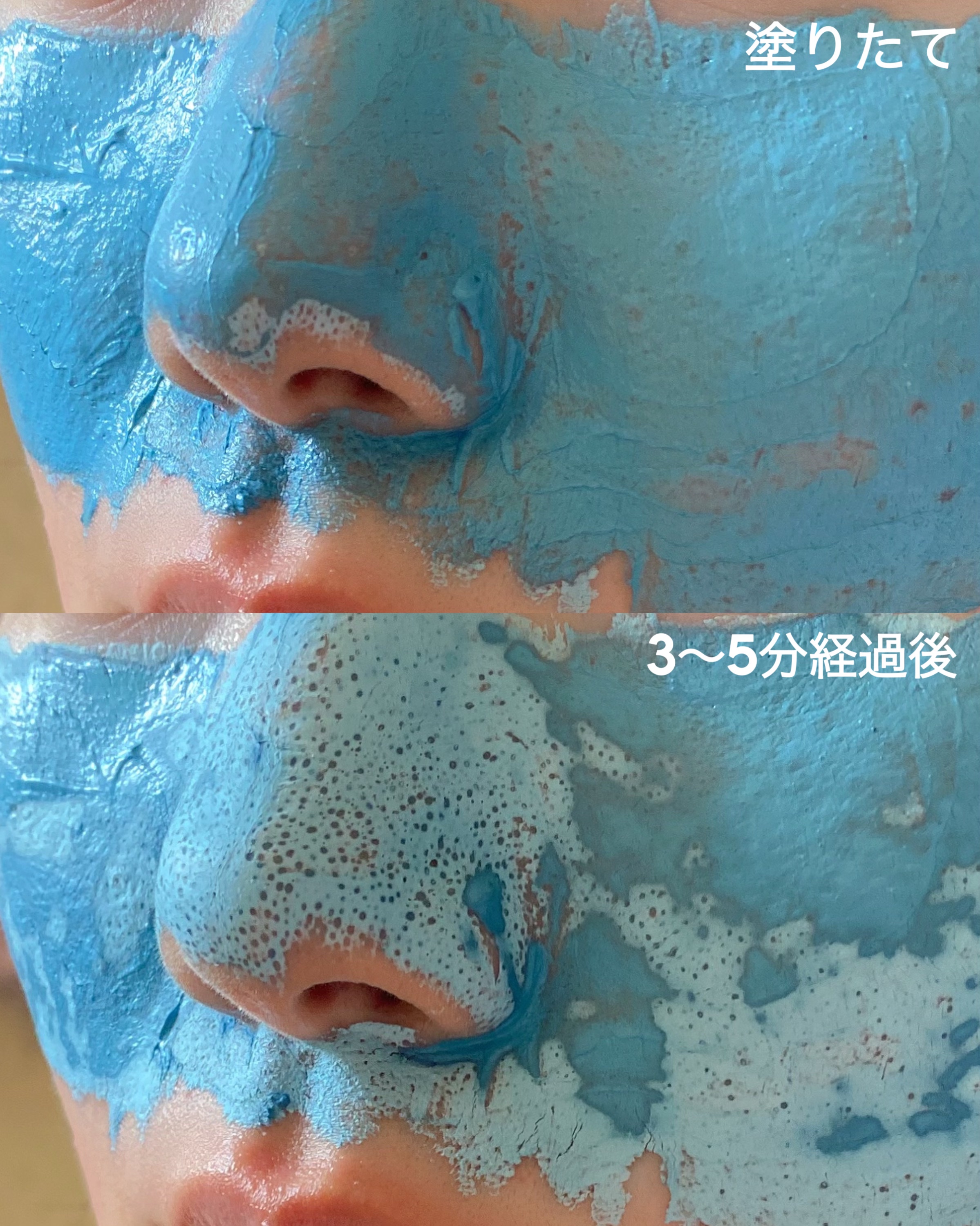 ゼロ毛穴パッド 2.0/MEDICUBE/トナーパッドを使ったクチコミ（3枚目）