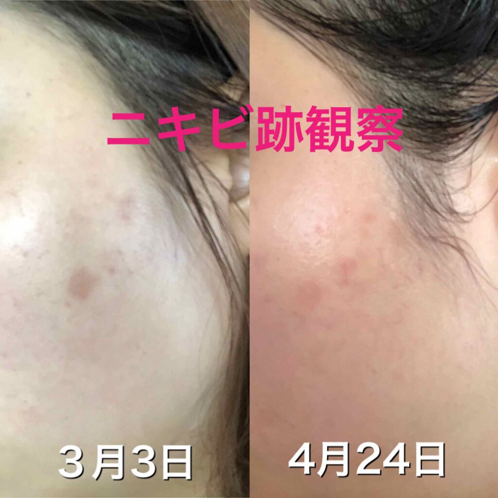 自然ごこち 茶 洗顔石けん/自然ごこち/洗顔石鹸を使ったクチコミ（1枚目）