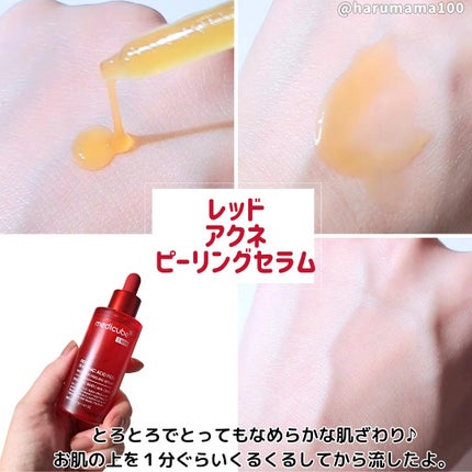 レッドアクネピーリングセラム/MEDICUBE/美容液を使ったクチコミ(2枚目)