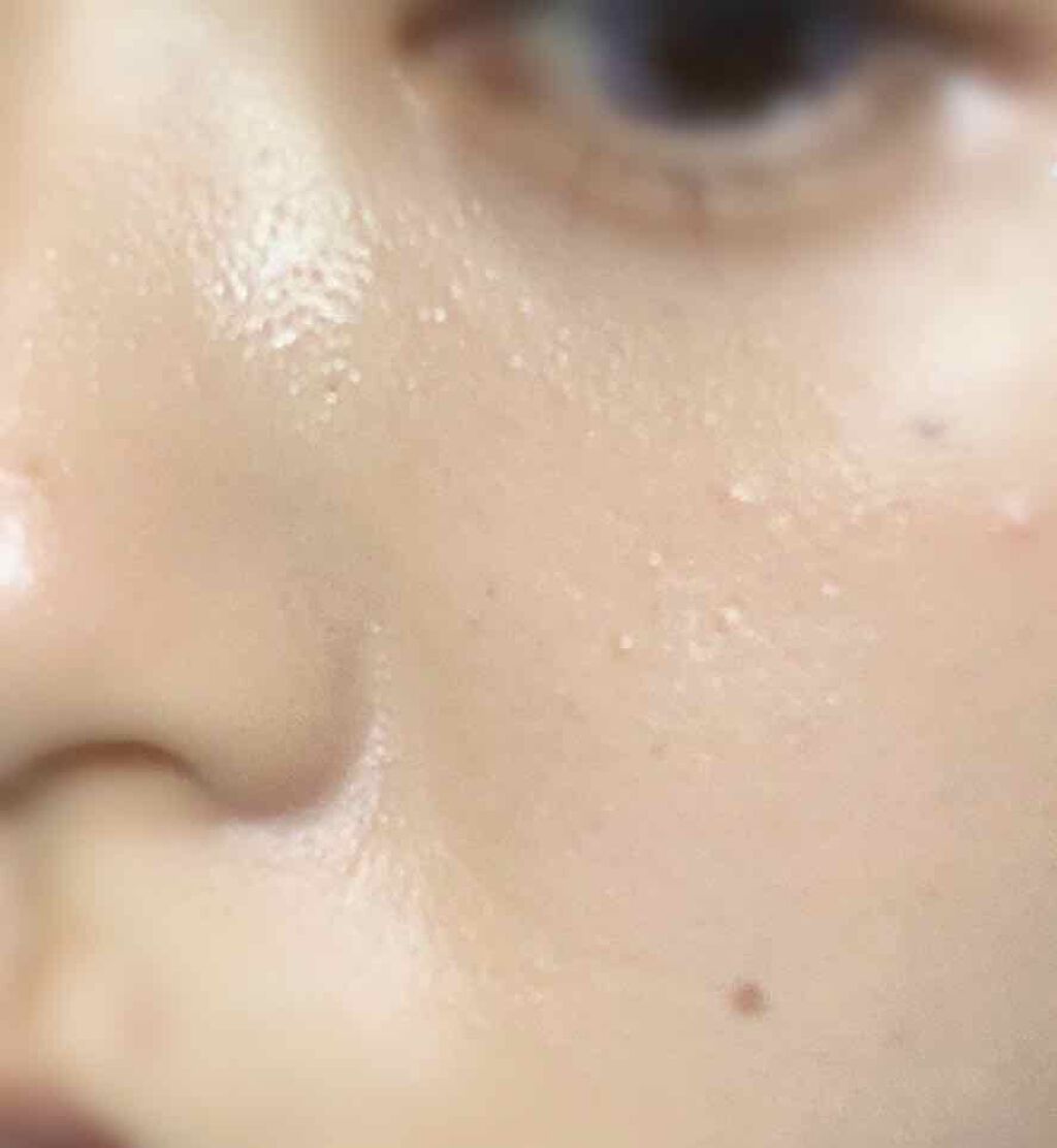 ããŒãã§ã¯ã ã€ã¬ãŒãµãŒ/ãã©ãŒãã¥ã³/åç²§äžå°ã䜿ã£ãã¯ãã³ãïŒ2æç®ïŒ