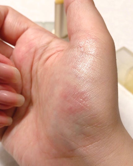 ð¥ð¢ð¬ð.ðððð çŸå®¹ã©ã€ã¿ãŒ on LIPS ã#PR#narka@narka_you2æ28æ¥çºå£²Sugar..ãïŒ3æç®ïŒ