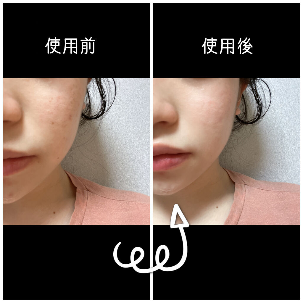 ザビタミンC23/IOPE/美容液を使ったクチコミ（2枚目）