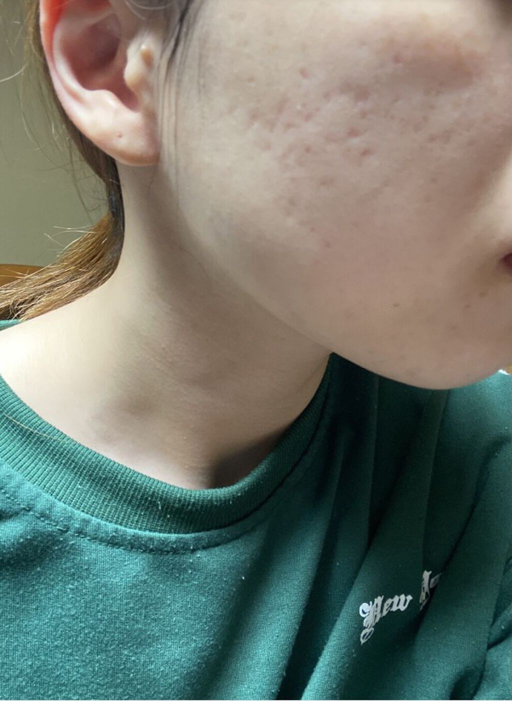 ビタライトビームエッセンシャルマスクEX/MEDIHEAL/シートマスク・パックを使ったクチコミ（1枚目）