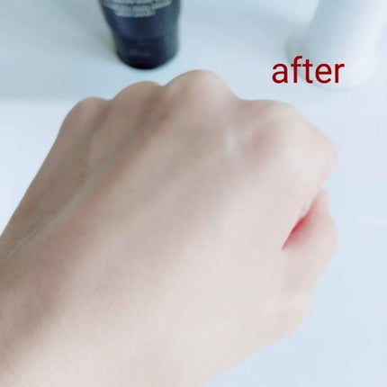 ニードルボディスクラブ/NNE/ボディスクラブを使ったクチコミ(7枚目)