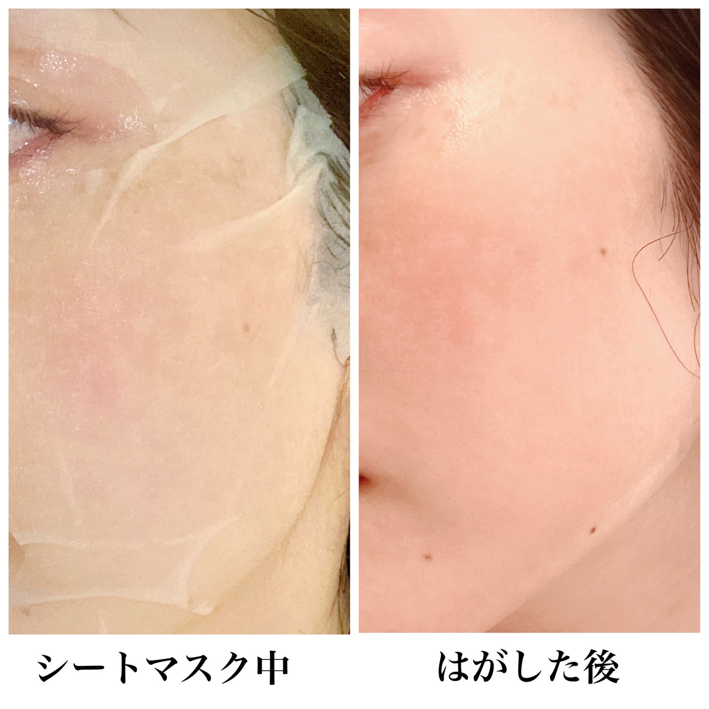 ピュアグラインディングクレンジングバーム/Dr.Althea/クレンジングバームを使ったクチコミ(8枚目)