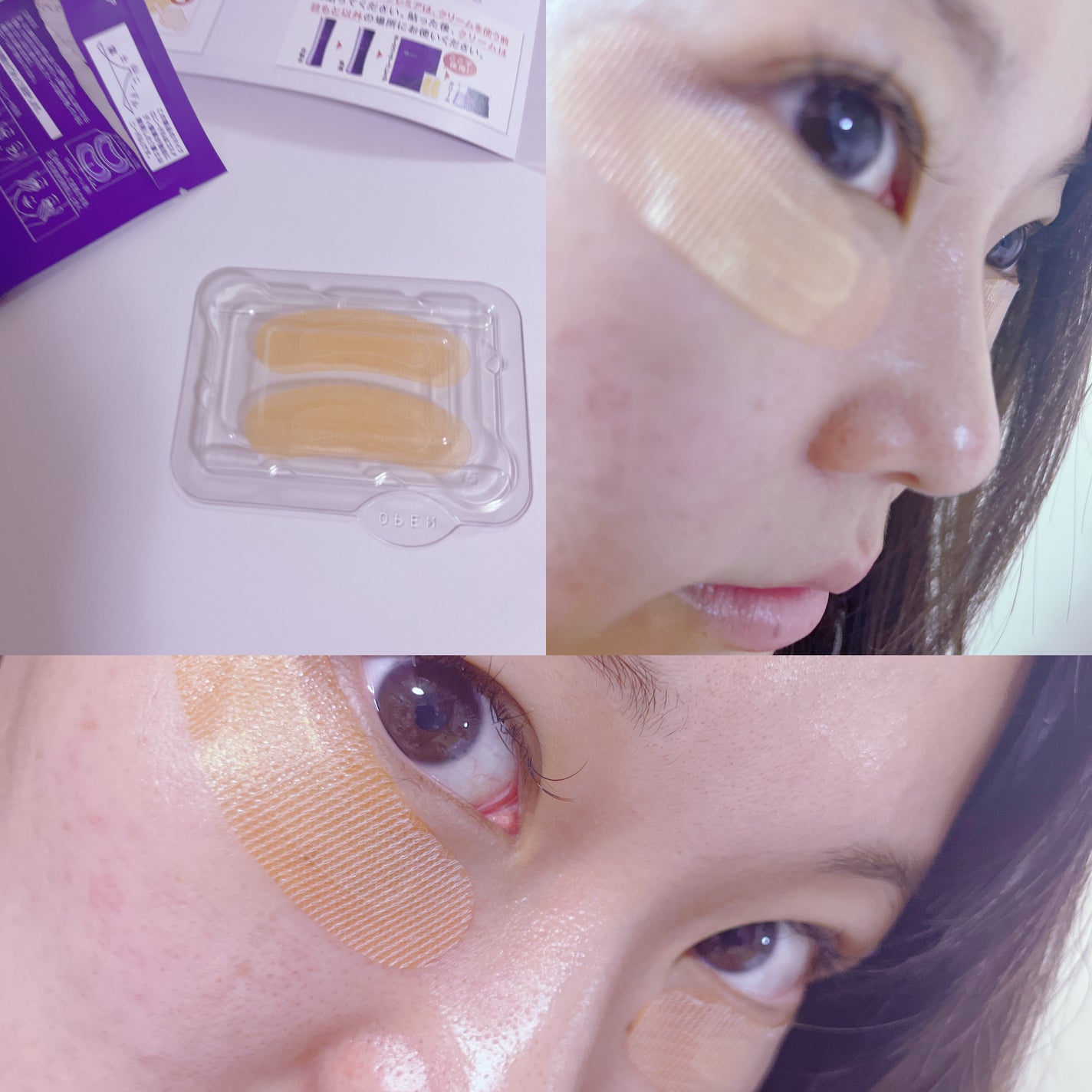 クオニス ダーマフィラープレミア/Quanis/シートマスク・パックを使ったクチコミ(3枚目)