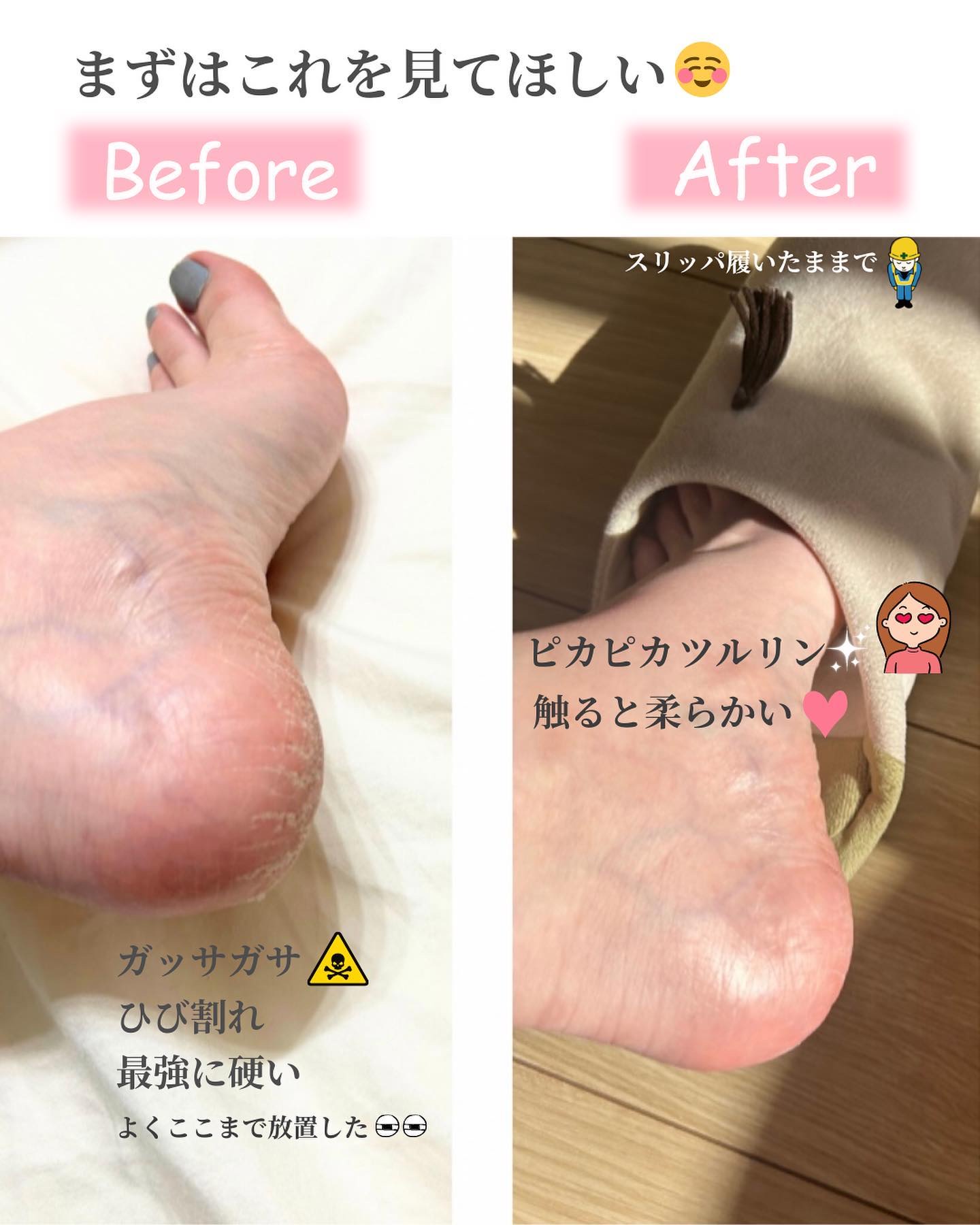 ディープモイスチャライジングクリーム/ドクター・ショール/レッグ・フットケアを使ったクチコミ（2枚目）