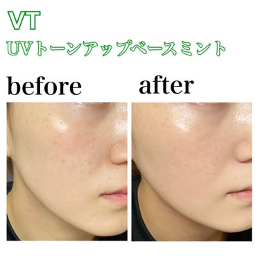 🌿CICAで仕上げるベースメイク🌿



VT 
CICA UVトーンアップベース ミント

価格　　1309円

内容量　30ml


4種類のカラーバリエーションから選べるこのトーンアップベースで私はニキビ跡や赤みが気になるのでミントを選びました💚
　

SPF50+/PA++++でしっかり紫外線から守ってくれる処方なのにシカをはじめとする成分が入っていて美肌ケアができる万能ベースです‼︎


私はちょこっと近くに出かけるときの日焼け止めや化粧下地として使っています^_^
　

香りはさっぱりとしたvt特有の香りです🌿



写真のように塗ってみるとテクスチャーはみずみずしいローションのような塗り心地で伸びがとても良くナチュラルにカバーされます^_^
　


私はファンデーションでがっつりカバーするので写真のようなカバーでも十分でしたが赤みが気になるときやしっかり赤みを抑えたい方は物足りないかもしれません💦



薄付きや少し肌荒れや赤みが気になるけど肌への負担は少なくメイクをしたい方にはいいと思います💡



私は肌荒れしやすいのでカラーコントロールより肌負担が少なく、美肌ケアができる化粧下地に魅力を感じました🥹



こちらは5in1のマルチベースになっており、

１つで５役の中身は

保湿ケア

肌トーンアップ

化粧下地

肌色の補正

UVケア　　　　　　　　です‼︎

　

普段、メイクにかける時間もなくでも肌のことを気にしたい私には手軽に使えるので良かったです^_^




そして下地を終えた後によくセットで使うファンデシーションが同じVTの


CICA エアリーフィットカバークッション　です！！


価格　　2640円

内容量　10g

カラー　21 ライトベージュ
　　　　（ワントーン明るい仕上がり）

SPF50+/PA+++



カラーは2種類で明るい方を選びました🌞



しっかり紫外線予防ができ、名前の通りとても軽い付け心地でした☁️


雫型のパフが細かいところまで塗りやすく、ファンデーションも適度に取れるので調節しやすかったです👏



写真のように薄づきでカバー力はそこまでなく、そばかすや赤みが少し薄くなって肌のトーンが上がりました。


個人的にはもう少しカバー力が欲しかったですがナチュラルな仕上がりなのでちょこっと近くへ出かける時などにこのクッションファンデを使っています🐶



こちらも美容成分配合でお肌に優しい処方です🌿


CICAHY ALON
ゆらぎ＆水分補給ケア

ティーツリー葉エキス
整肌＆しっとり肌荒れを防ぐ

シラカバエキス
水分補給&バリア機能をサポート

ノーセバムパウダー
皮脂コントロール


紫外線予防から美肌ケアまで考えられた多機能ベースでカバー力は低いですがお肌が気になる時やナチュラル仕上がりが好きな方におすすめです❤️‍🔥


#VT
#CICA
#エアリーフィットカバークッション
#ライトベージュ
#UVトーンアップベース
#ミント
#1日1CICA
#ライトベージュ
#21

の画像 その2