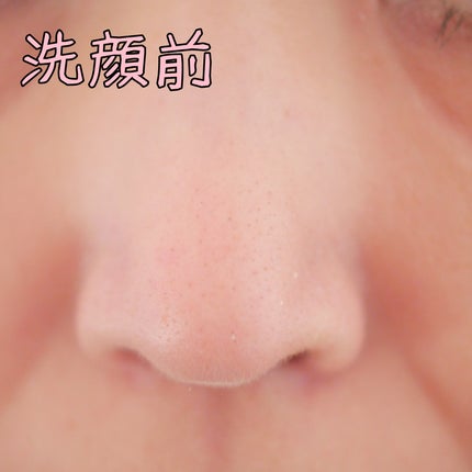 薬用VC泡フォーマー/VCシリーズ/洗顔フォームを使ったクチコミ(8枚目)