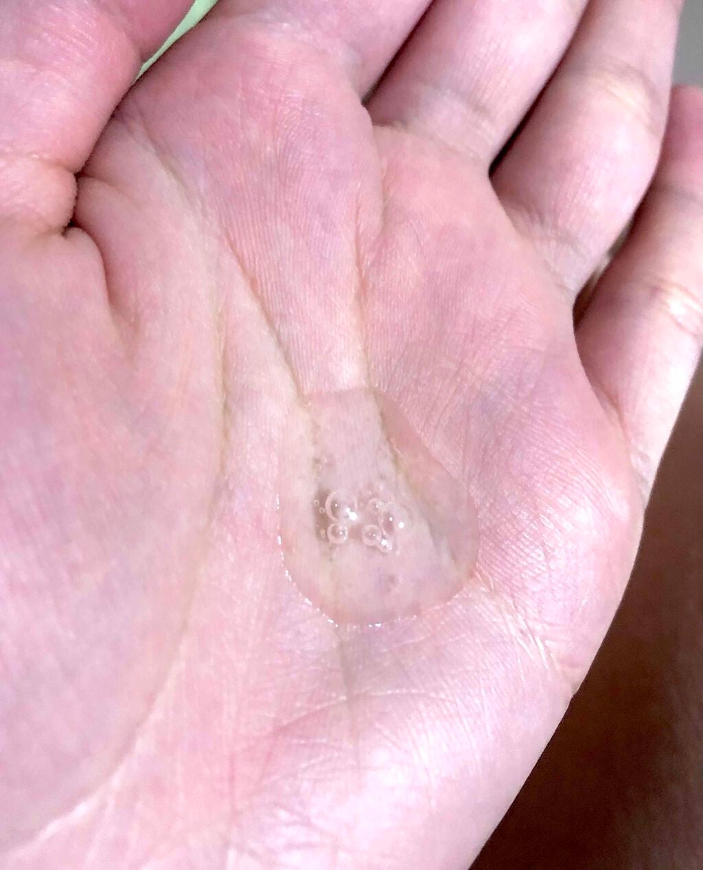 薬用アフターケアエッセンス/ミュゼコスメ/ボディローションを使ったクチコミ(2枚目)