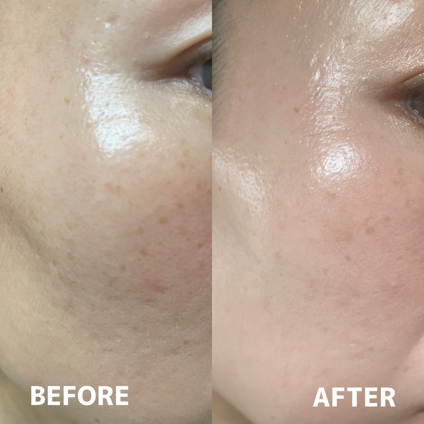 グロウクッションファンデーション/NUDIQUE/クッションファンデーションを使ったクチコミ(4枚目)