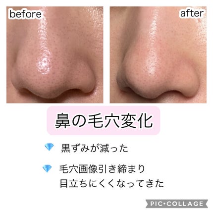 フェイシャル トリートメント エッセンス/SK-II/化粧水を使ったクチコミ(3枚目)