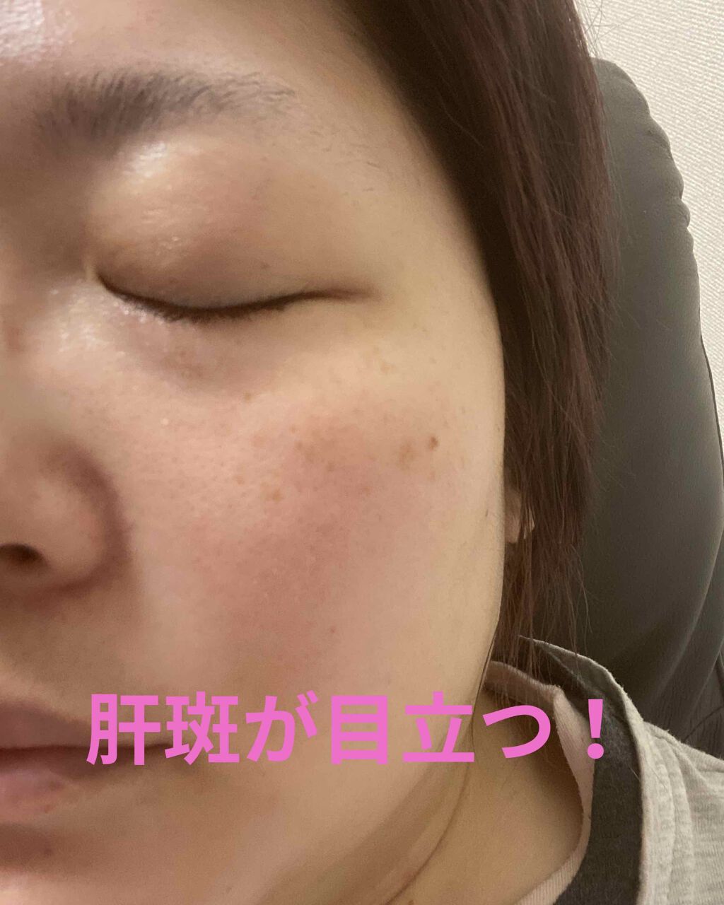 メラノフォーカスＶ/HAKU/美容液を使ったクチコミ（3枚目）