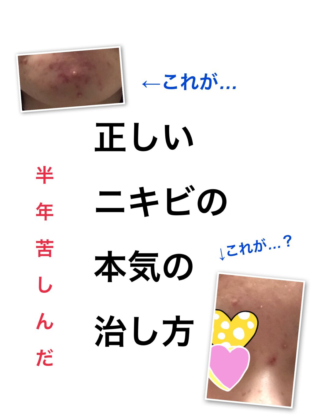 薬用 しみ 集中対策 美容液/メラノCC/美容液を使ったクチコミ(1枚目)