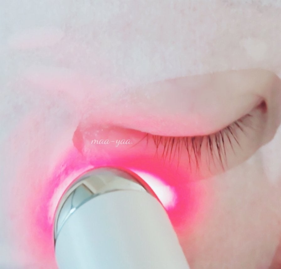 目元美顔器/ANLAN/美顔器・マッサージを使ったクチコミ(2枚目)