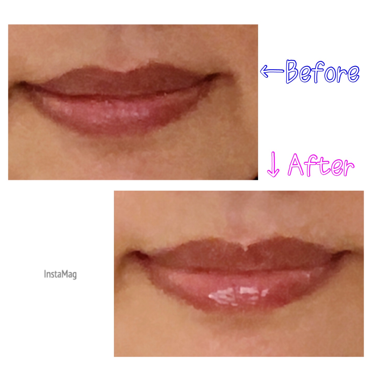 キューミ―ボムショットリッププランパー/AGARISM/リッププランパーを使ったクチコミ（3枚目）