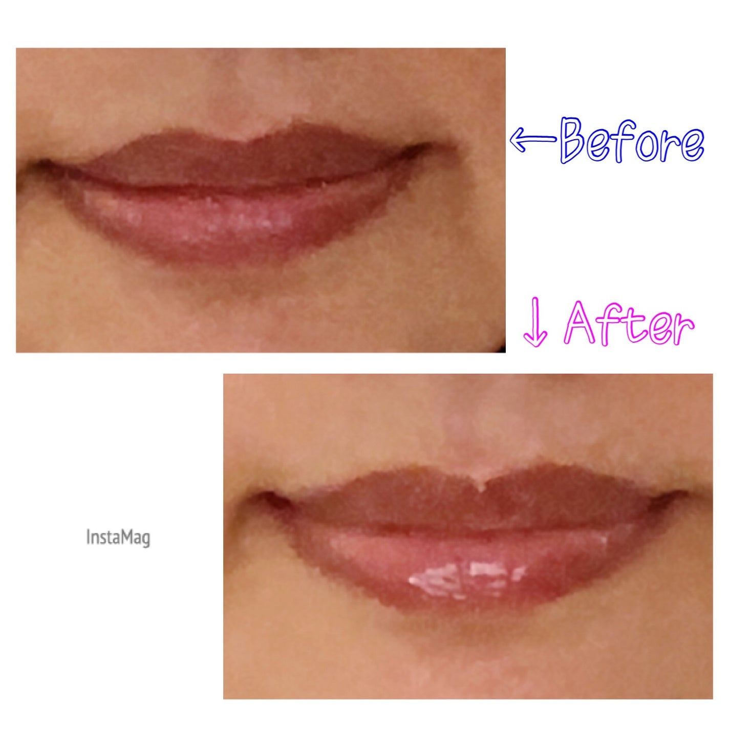 キューミ―ボムショットリッププランパー/AGARISM/リッププランパーを使ったクチコミ(3枚目)