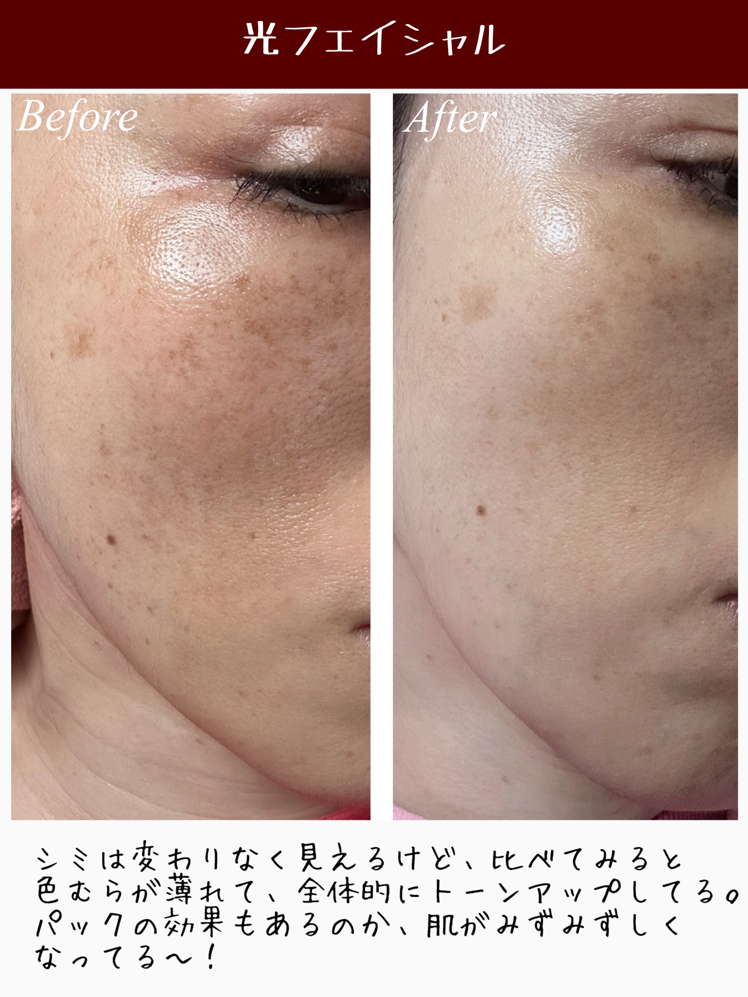 を使ったクチコミ（3枚目）