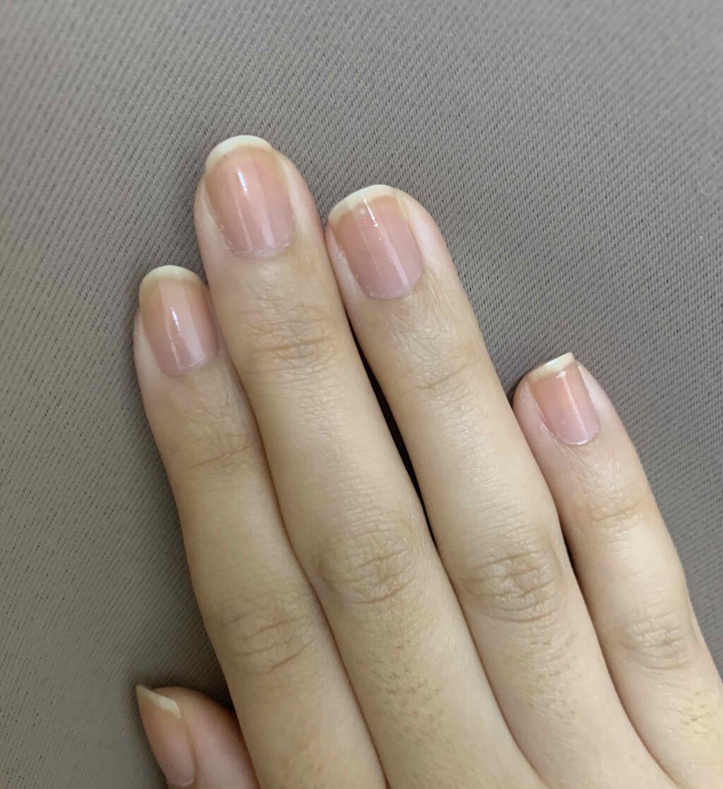 アンティセプト Lcnの口コミ 育爪 2ヶ月で変化あり 爪が短いのがコン By Sparkle Make 65h 混合肌 代後半 Lips
