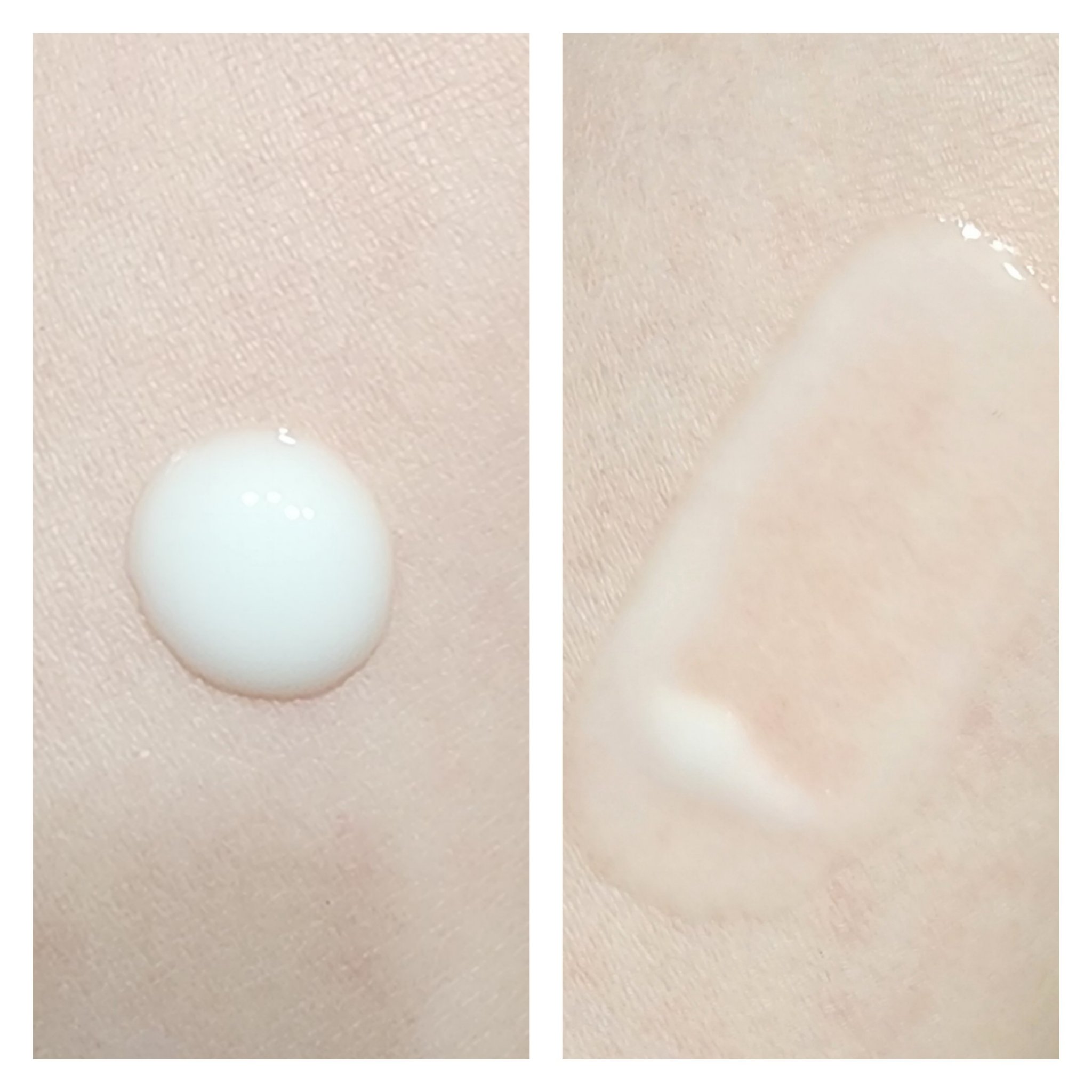 エージプロテオム/エステダム/美容液を使ったクチコミ（3枚目）