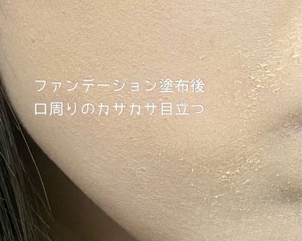 レチノールA 1% アドバンスドリバイタリゼーションクリーム/Life-flo/フェイスクリームを使ったクチコミ(4枚目)