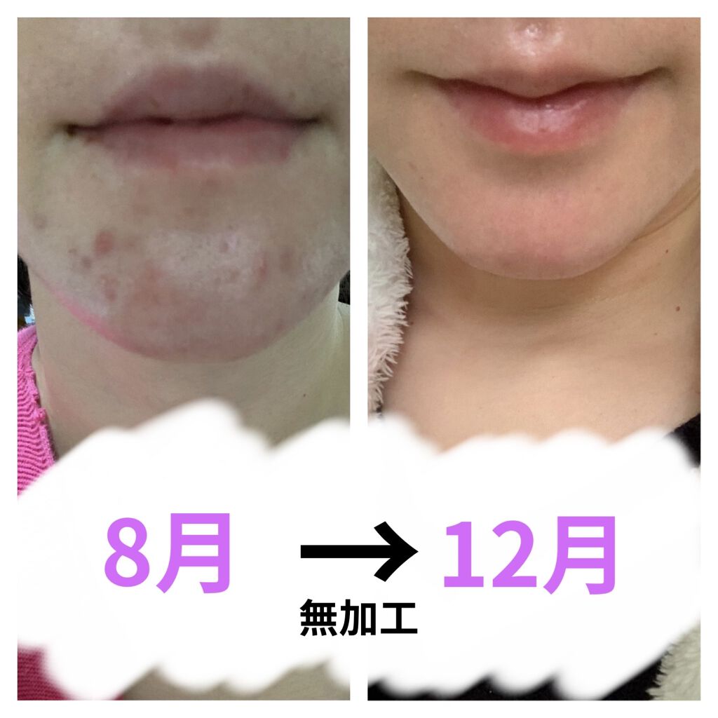 新エバユースＢ26 (医薬品)/エバユース/その他を使ったクチコミ（1枚目）