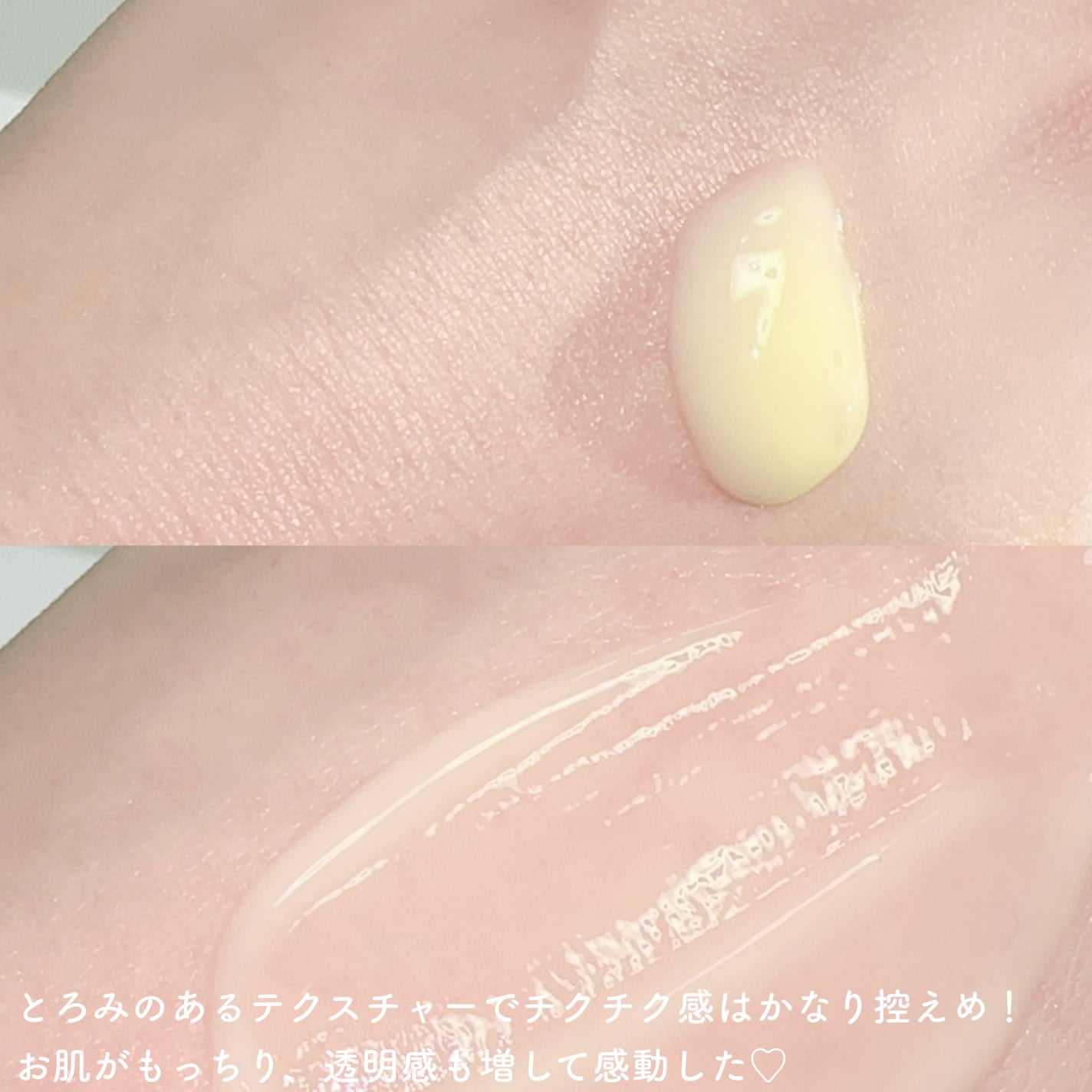 六花 on LIPS 「ピュアビタミン15%にスピキュール300ショット!高濃度ビタミ..」(4枚目)
