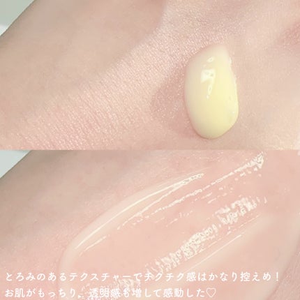 六花 on LIPS 「ピュアビタミン15%にスピキュール300ショット!高濃度ビタミ..」(4枚目)