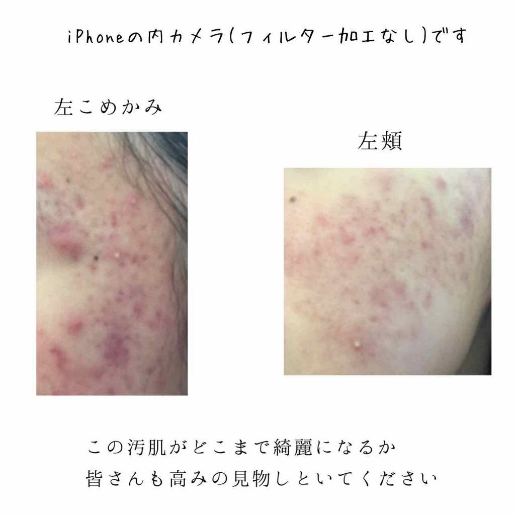 ハトムギ化粧水(ナチュリエ スキンコンディショナー R )/ナチュリエ/化粧水を使ったクチコミ（3枚目）