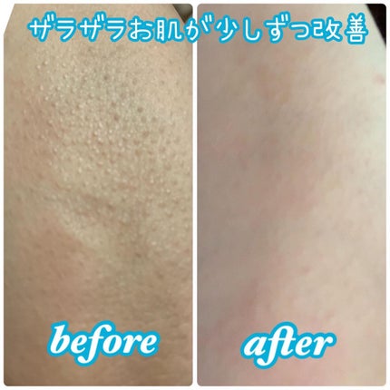 エマルジョンリムーバー 300ml/200ml/水橋保寿堂製薬/その他洗顔料を使ったクチコミ(5枚目)