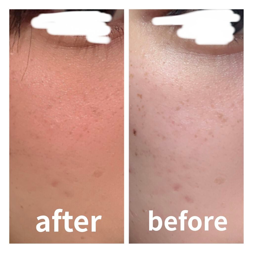 リアルカバーリキッド(ライトグロウ)/KATE/リキッドファンデーションを使ったクチコミ(3枚目)