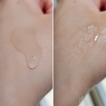 エファクラ ピールケア セラム/ラ ロッシュ ポゼ/美容液を使ったクチコミ(3枚目)