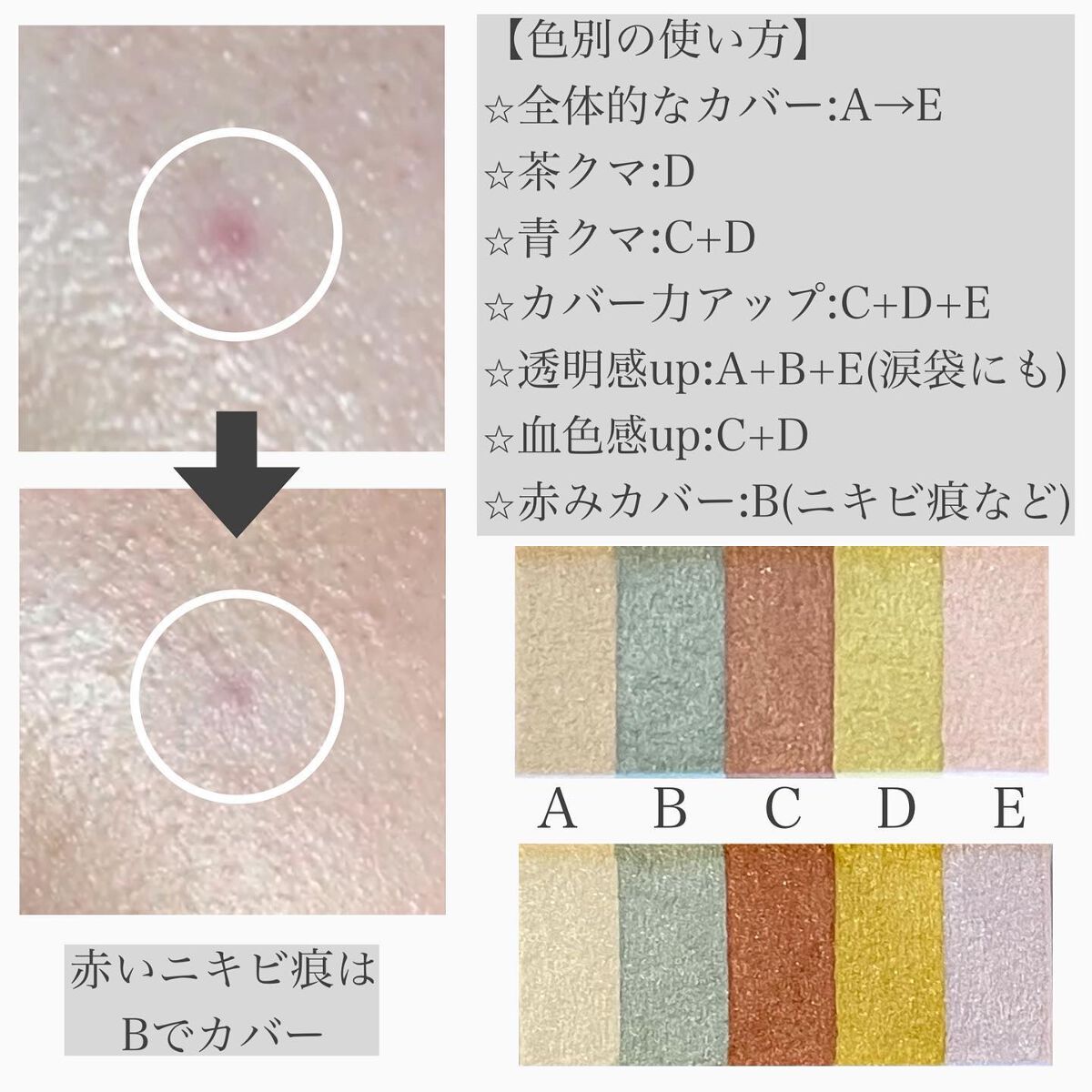 パステルヴェールコンシーラー/キャンメイク/パレットコンシーラーを使ったクチコミ(5枚目)