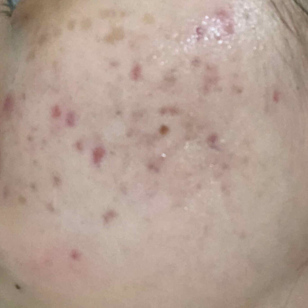 キールズ DS クリアリーブライト エッセンス[医薬部外品]/Kiehl's/美容液を使ったクチコミ（2枚目）