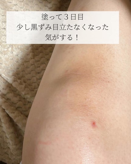 BnDアンダーアームクリーム(ボディクリーム)/BnD/デリケートゾーンケアを使ったクチコミ(5枚目)