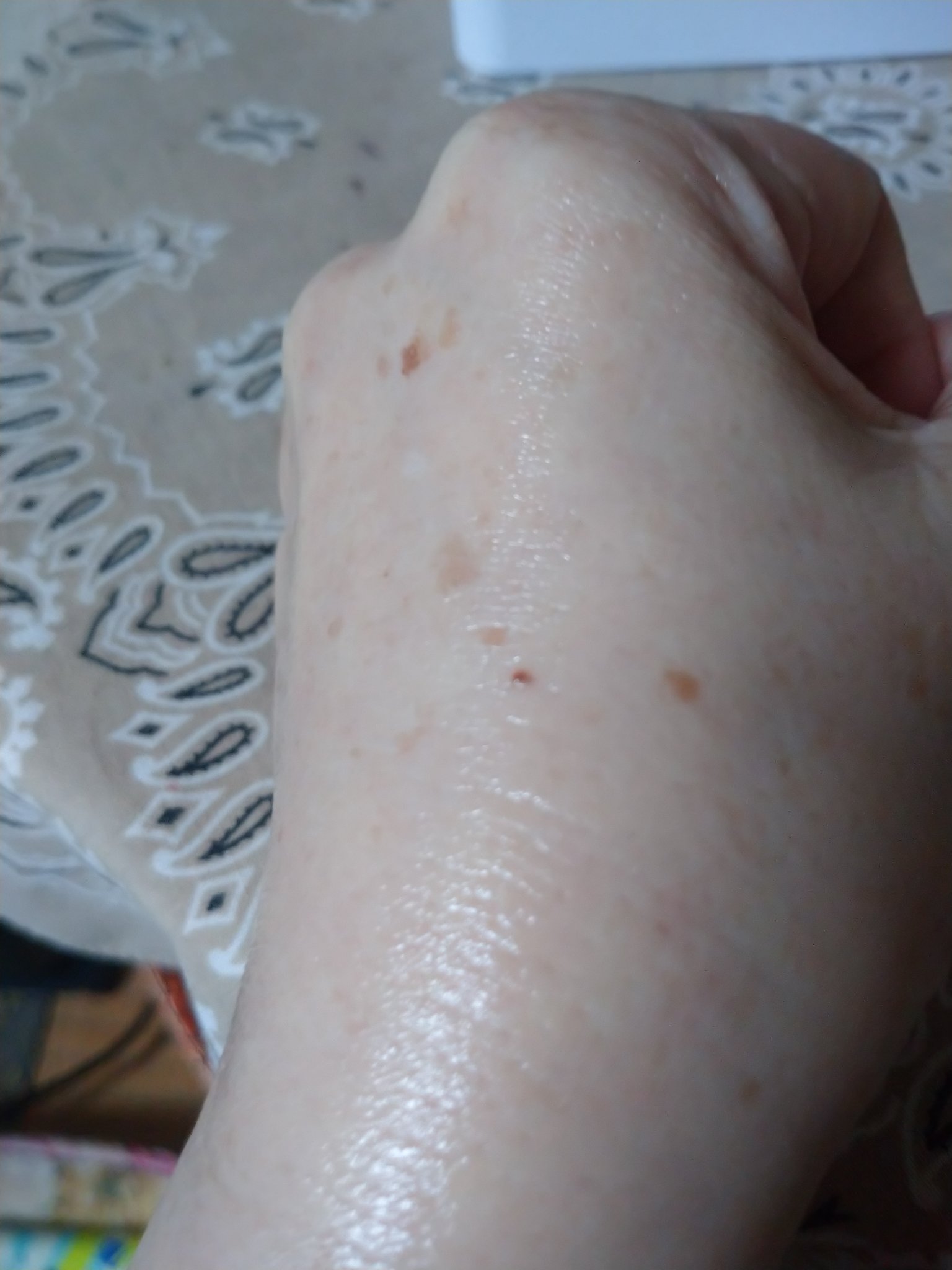 グリーンタンジェリン ビタC ダークスポットケアセラム/goodal/美容液を使ったクチコミ（3枚目）