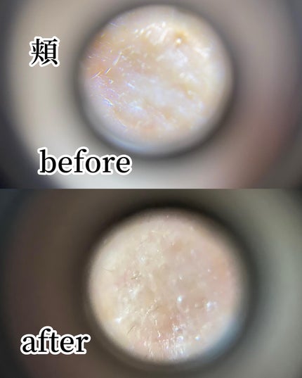 リードルショット300/VT/美容液を使ったクチコミ(7枚目)