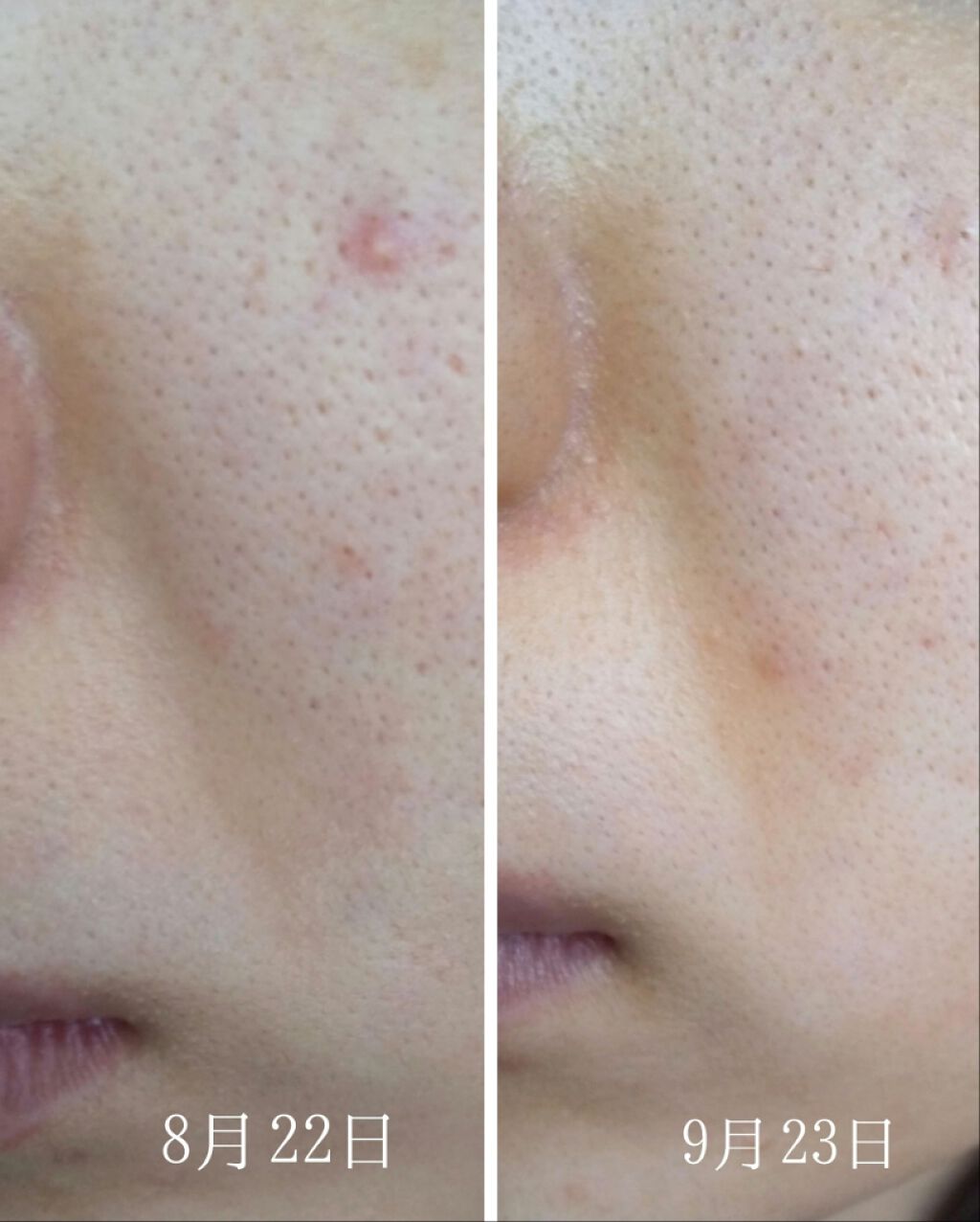 LA10+HAフェイスセラム/The Ordinary/ピーリングを使ったクチコミ(3枚目)