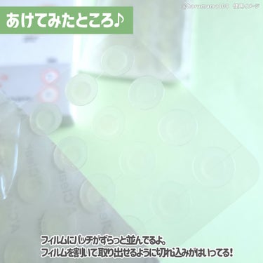 エイクリアスポットキュアパッチ /Dr.G/にきびパッチを使ったクチコミ（3枚目）