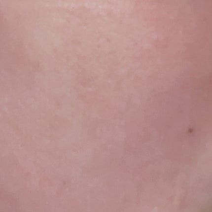 ピックアンドクイックマスク/DEWYTREE/シートマスク・パックを使ったクチコミ(5枚目)