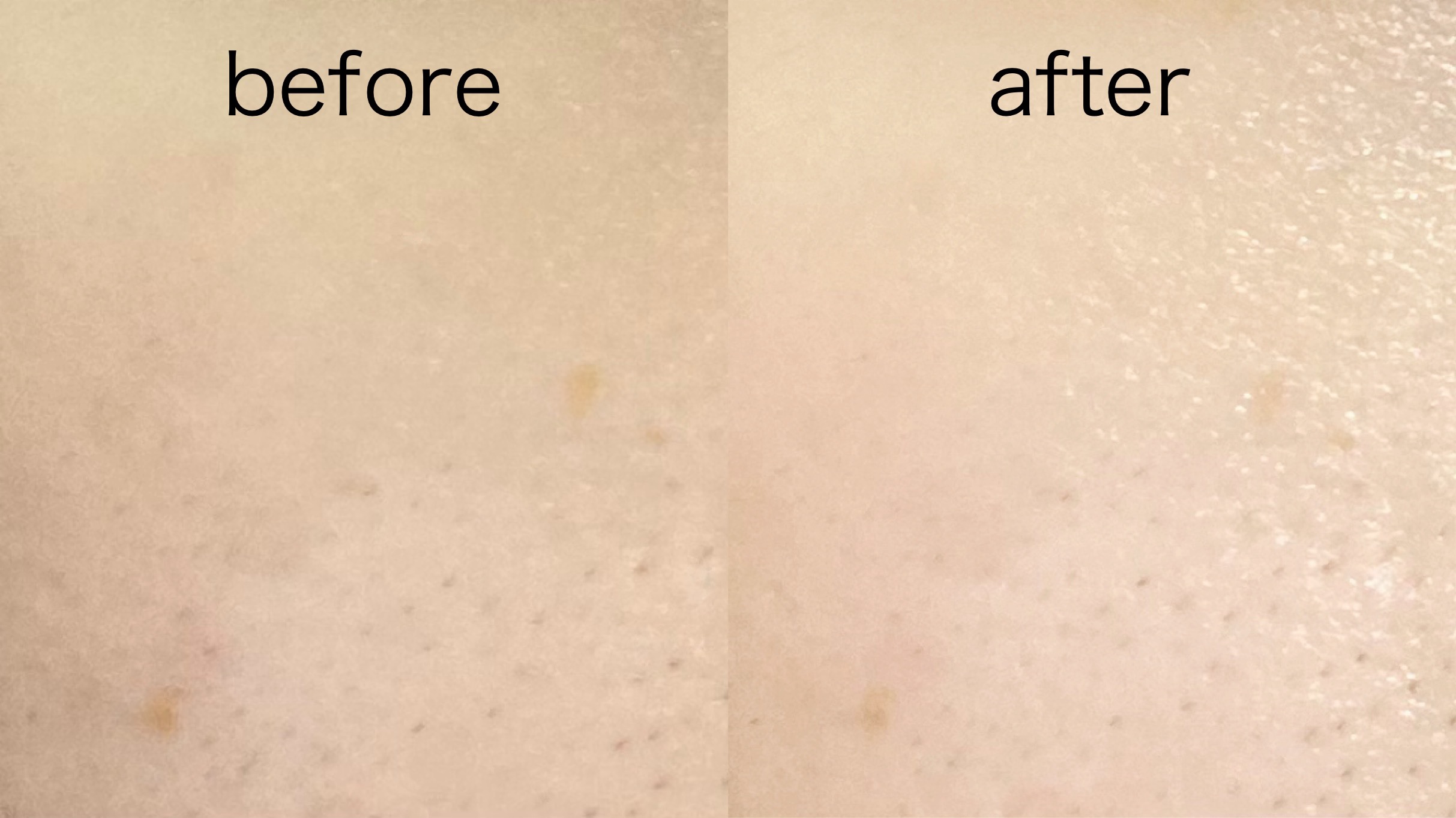 リードルショット300/VT/美容液を使ったクチコミ（3枚目）