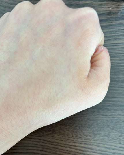 ノスカナイン トラブル セラム/FATION/美容液を使ったクチコミ(5枚目)