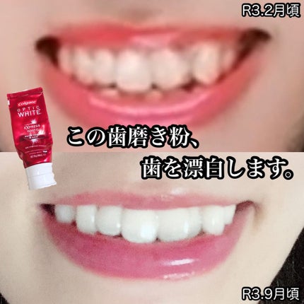 コルゲート オプティックホワイト/colgate/歯磨き粉を使ったクチコミ(1枚目)