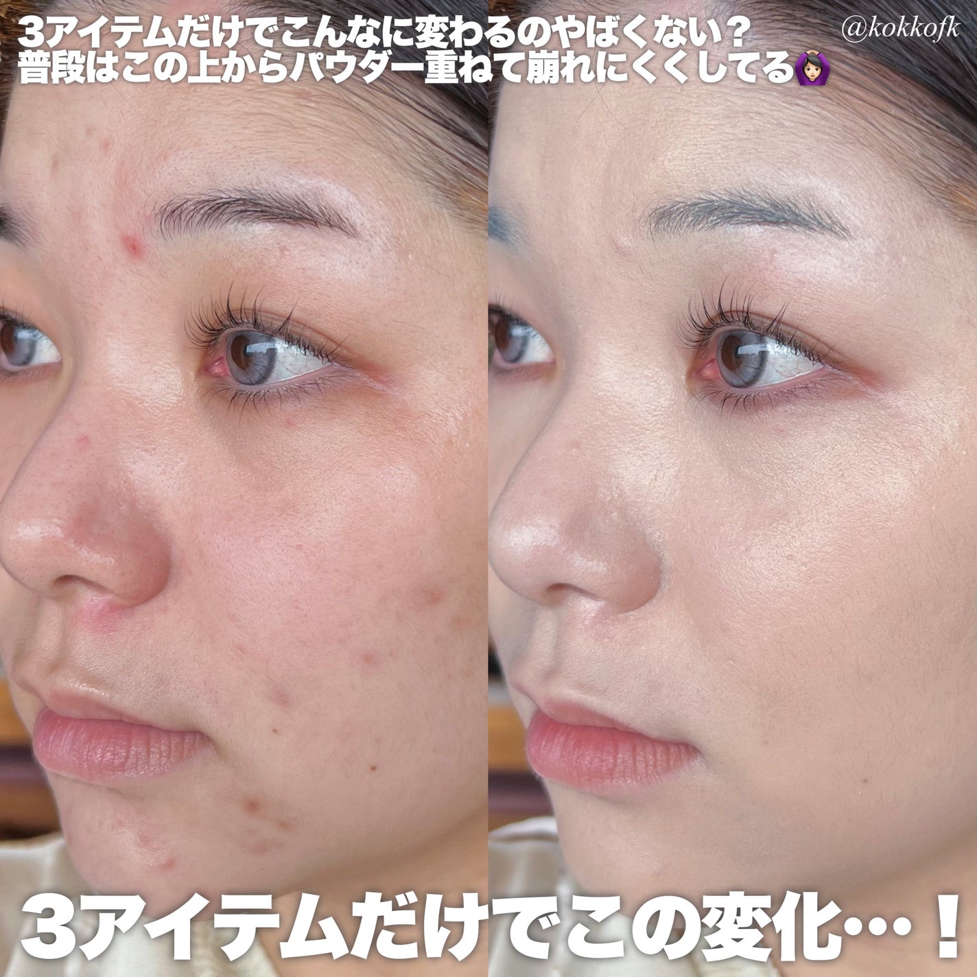 ラディアントクリーミーコンシーラー/NARS/リキッドコンシーラーを使ったクチコミ(2枚目)