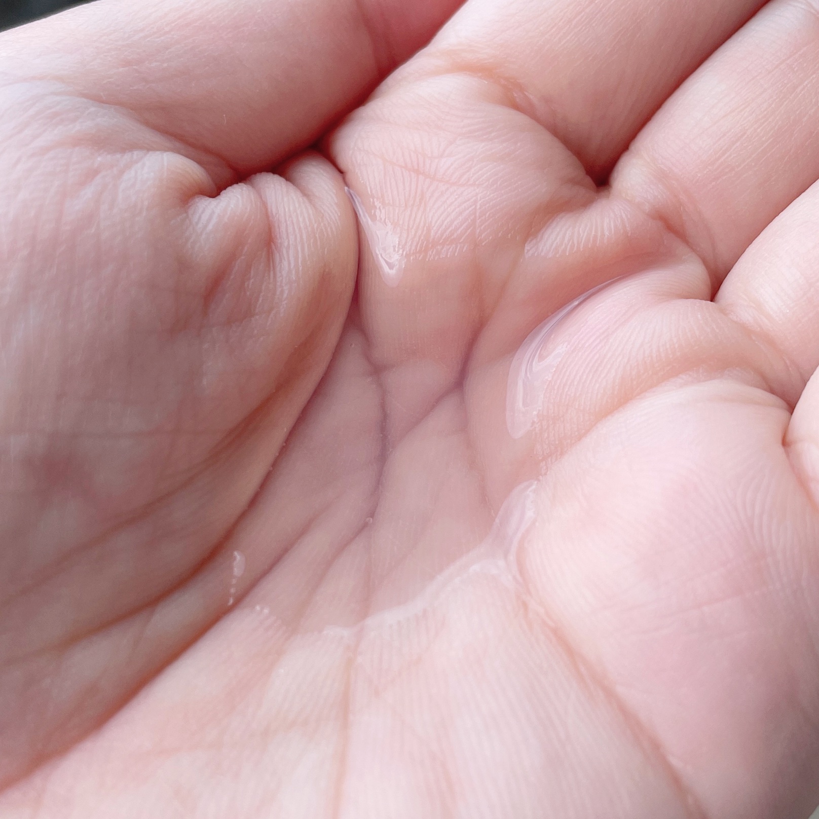 オイデルミン エッセンスローション/SHISEIDO/化粧水を使ったクチコミ（2枚目）