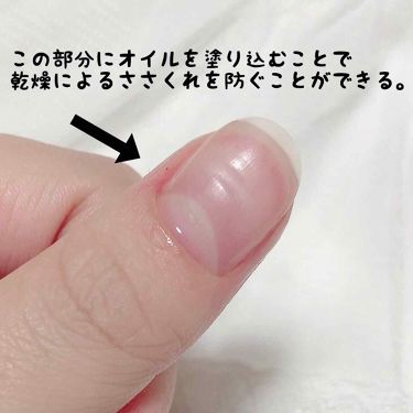 Ac キューティクルオイル Ac Makeupの使い方を徹底解説 100円でネイルケアはじめよう キューテ By ゆず 混合肌 代前半 Lips
