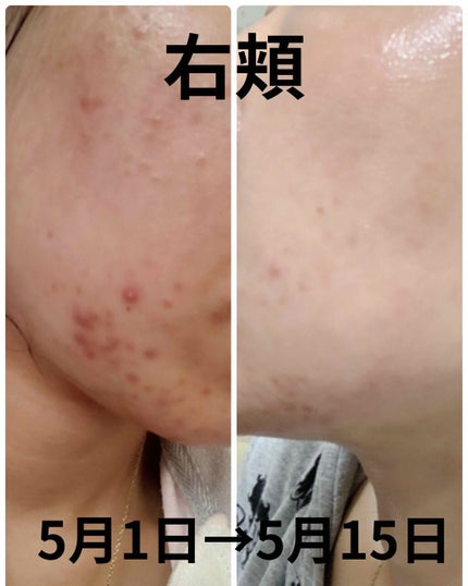 ãšããã¥ãªã²ã«/ãã«ãæ ªåŒäŒç€Ÿ/ãã®ä»ã䜿ã£ãã¯ãã³ãïŒ3æç®ïŒ